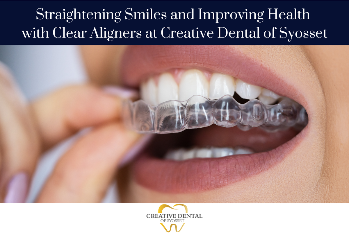 Clear Aligners and Invisalign in Syosset, NY: Cost, Timeline, Guide