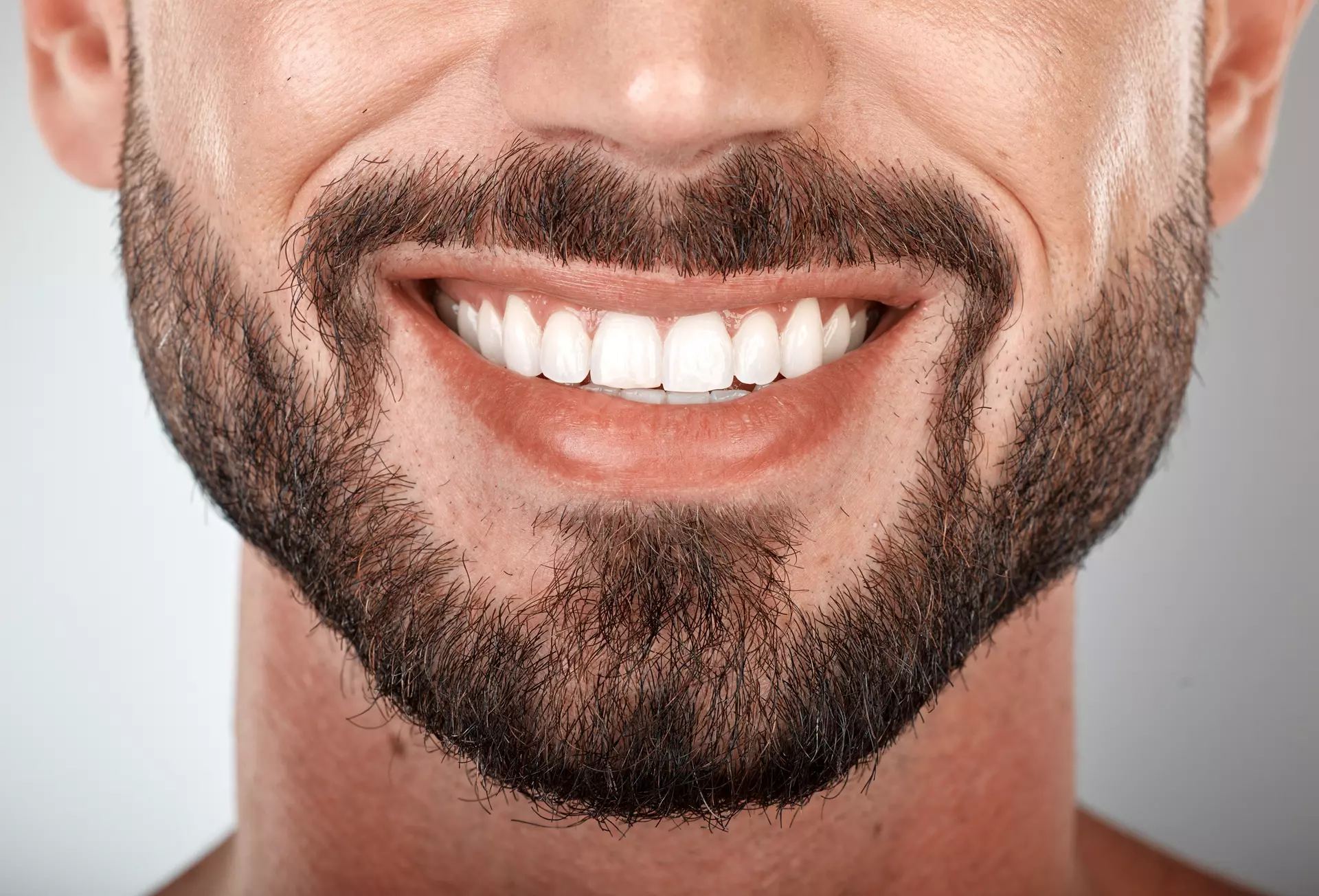 Why Dental Implants Are the Gold Standard for Tooth Replacement