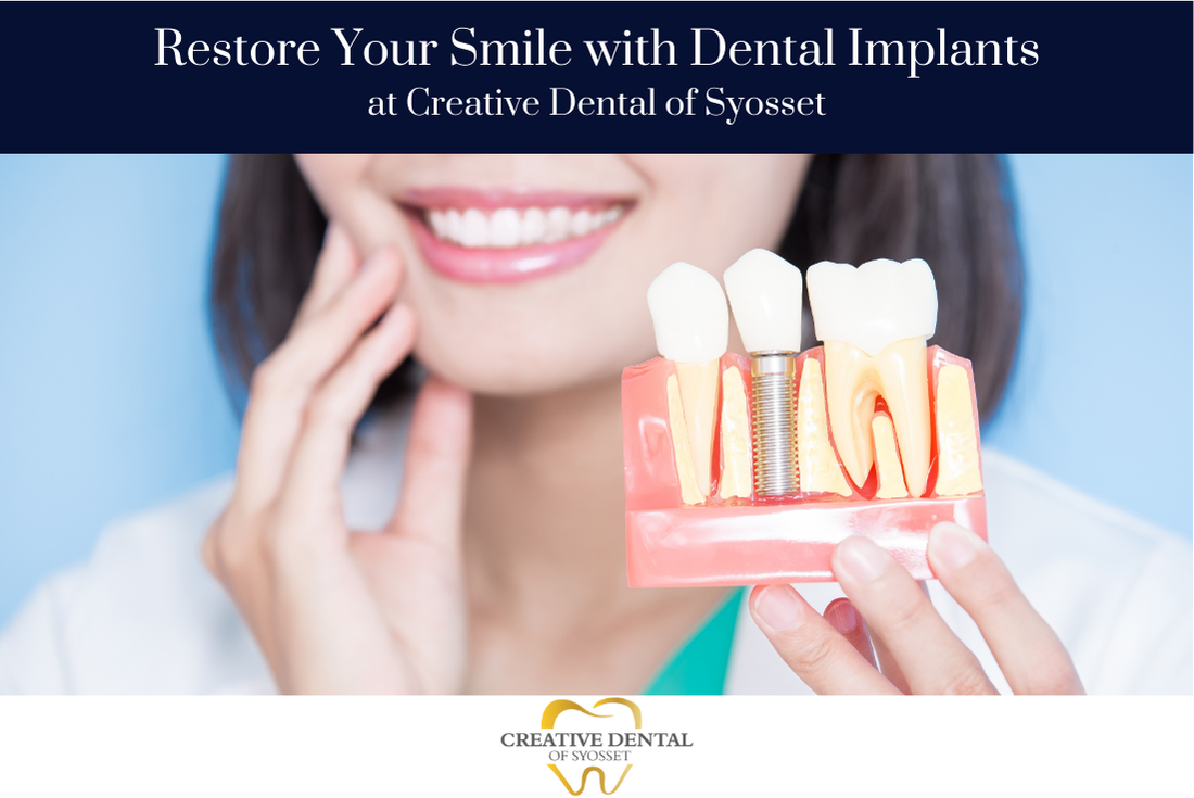 Dental Implants in Syosset, NY: Cost, Procedure, FAQ