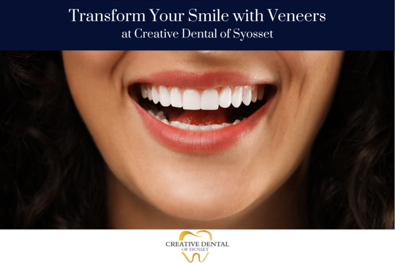 Transform Your Smile with Veneers at Creative Dental of Syosset